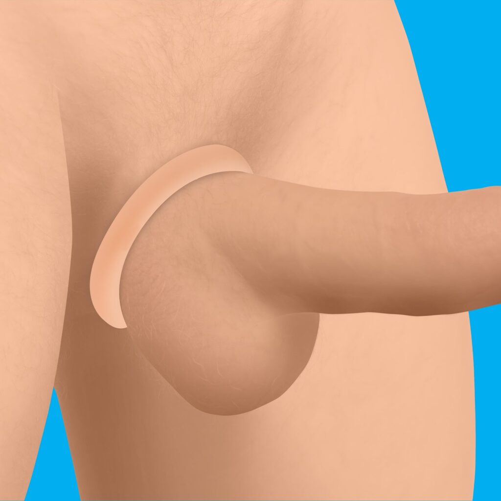 Discreet Silicone Cock Ring Set – Light